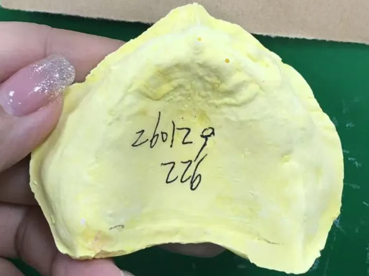 齿科3d模型
