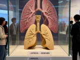 Lung Medical Education Model-0