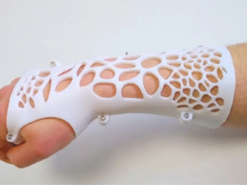 Férula de Brazo Transpirable 🦾 Férula de Brazo Ergonómica