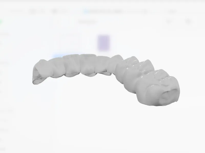 齿科3d模型