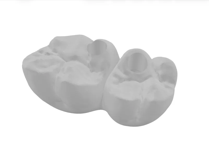 齿科3d模型