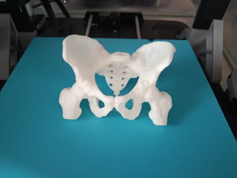 Male Pelvis