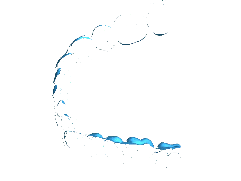 Plaster model up and low jaw scanned with Intraoral scanner
