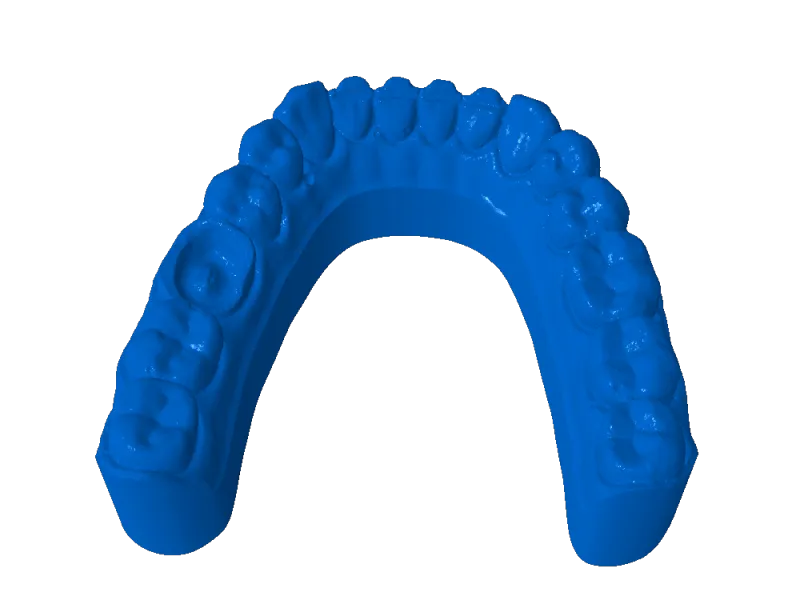stijf model M onderboog