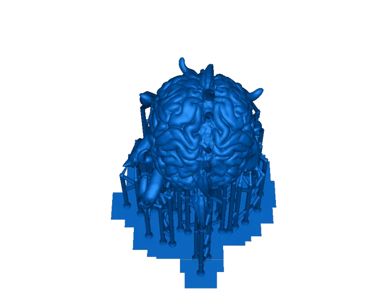 Cerebro de anciano