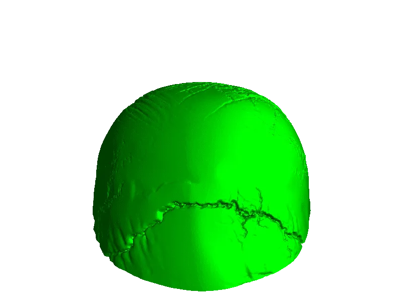 cranio umano