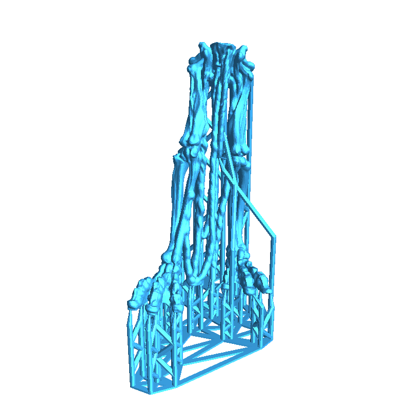Dead Ringer 3d Model Other STL Download - Dead Ringer - Skin Walkers-Presupported ...