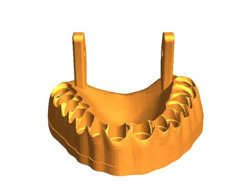 denture hex bit holder by iplop