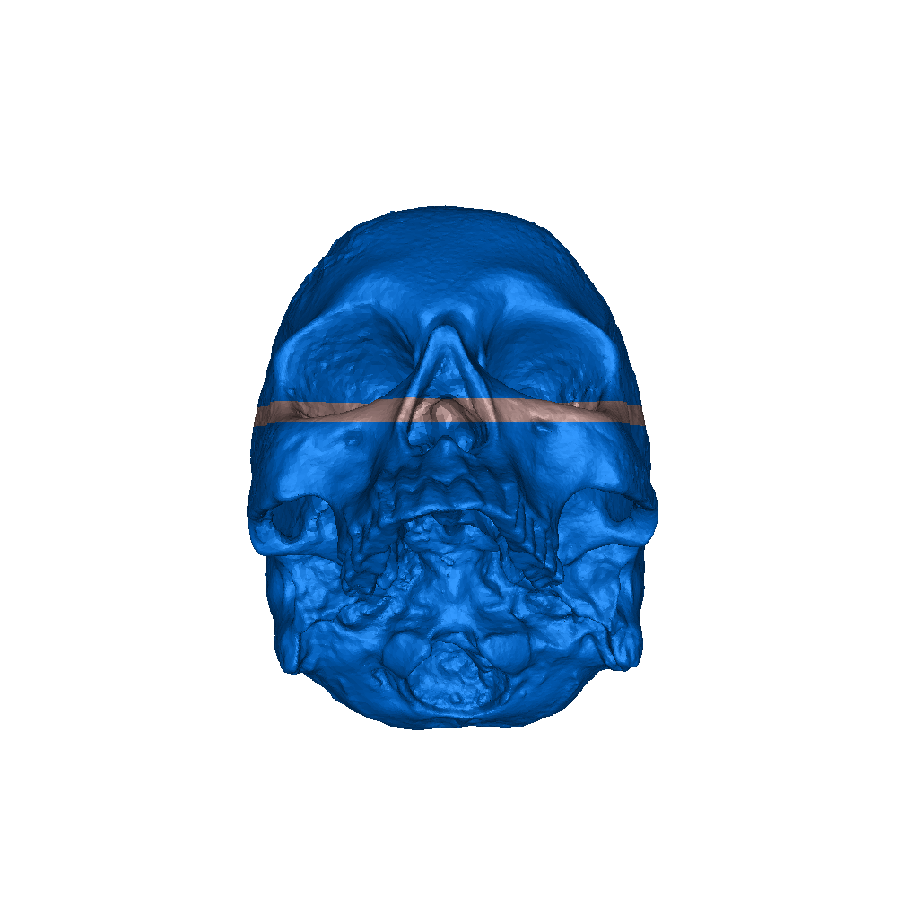 Human Skull