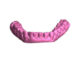 Full Mouth Dental Scan-1
