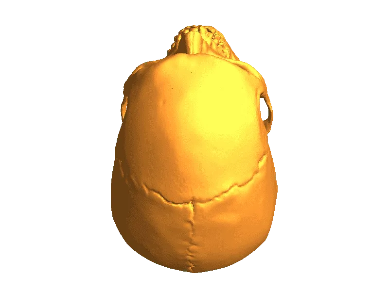 Skull Human CT Scan