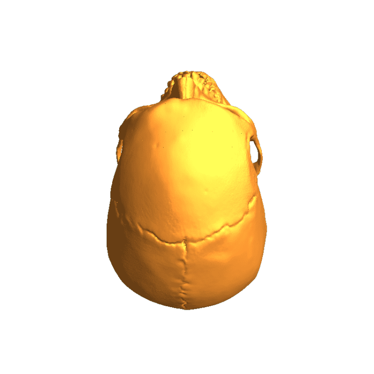 Skull Human CT Scan