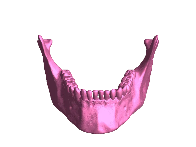 Skull's mandible
