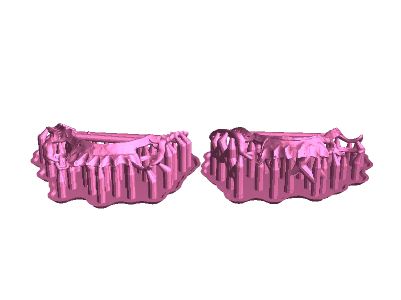 Protesis removible stl