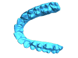Plaster model up and low jaw scanned with Intraoral scanner-1