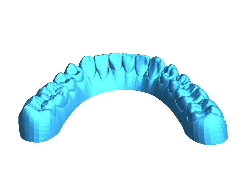 Dentes