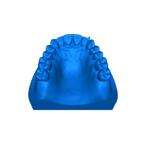 Upper Jaw Gary Alone