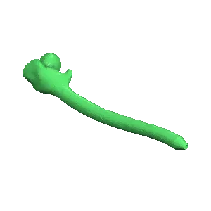 Hipen (Hip bone pen)